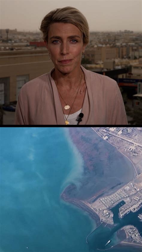 Student loses eye after being struck at ‘No Kings’ protest | CNN