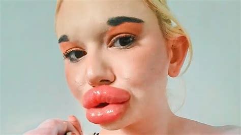 Plastic surgeon reacts to shocking TikTok videos