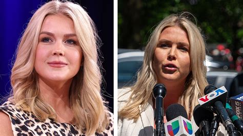 Before & after pics show how lip filler transformed Karoline Leavitt