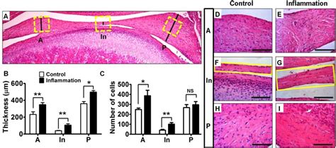 Sustained Inflammation Induces Degeneration of the Temporomandibular ...