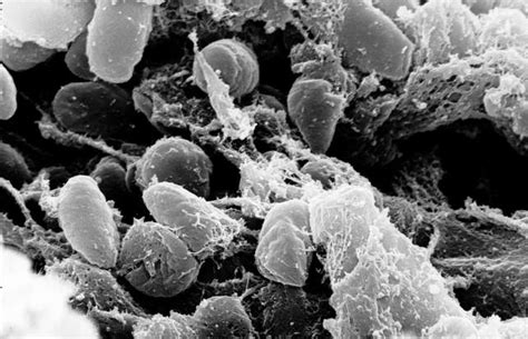 10 diseases that are extremely lethal