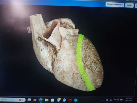 Cardiovascular APR Flashcards | Quizlet