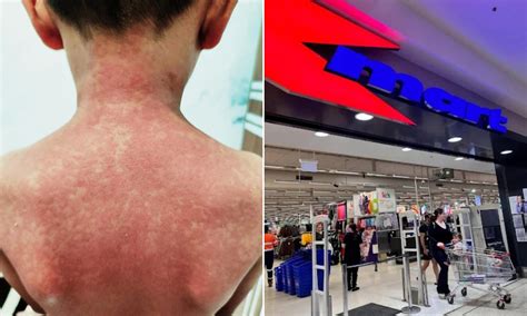 Urgent health alert over highly contagious virus as infected case visits several stores