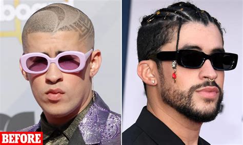 Plastic surgery experts reveal the procedures rumored to be behind Bad ...