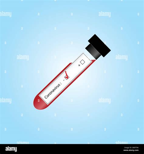 Infectious disease test Stock Vector Images - Alamy