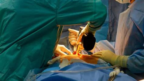 10-inch surgical instrument left inside cancer patient’s abdomen ...