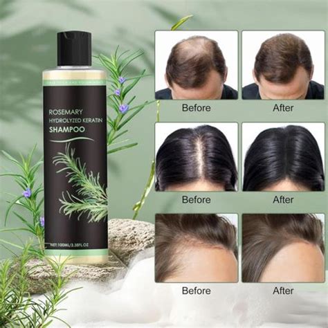 RIDOY Rosemary Keratin Shampoo | Advanced Hair Wellness Support Line ...