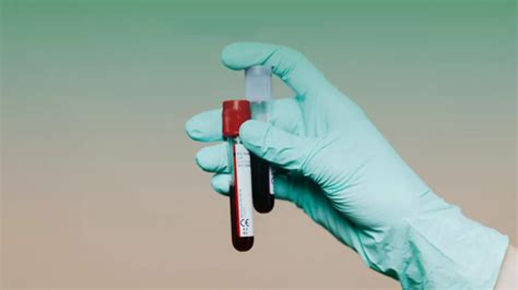 New Blood Type Discovered: Only One Person in the World Has It