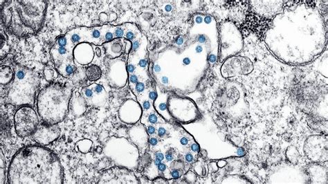 Viruses: What are they, and what do they do?