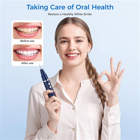 Plaque Remover for Teeth - Tartar Remover for Teeth, Dental Calculus Remover Teeth Cleaning Kit