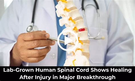 Lab-Grown Human Spinal Cord Shows Healing After Injury in Major ...