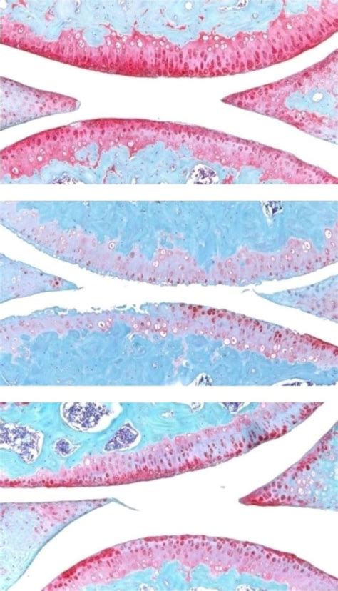 Stanford scientists found a way to regrow knee cartilage: without ...