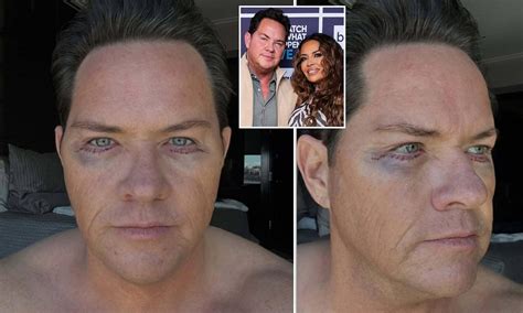Real Housewives star's fiancé shocks fans with dramatic plastic surgery ...
