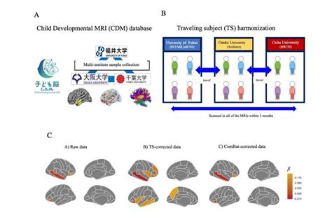 MRI correction method improves understanding of brain structure in ...