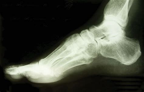 X-ray | Definition, History, & Facts | Britannica