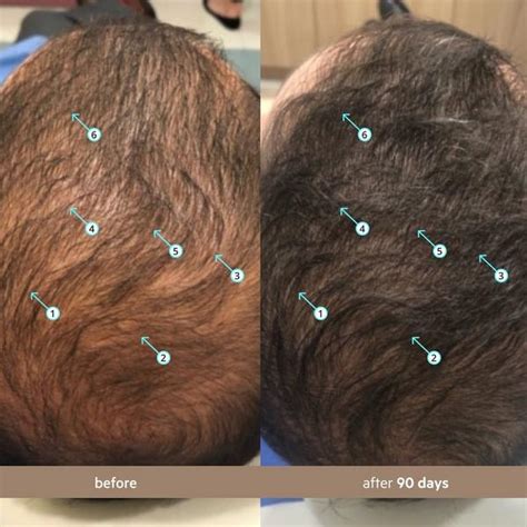 DS Laboratories - Spectral Men’s (DNC-N) Hair Density Serum with ...