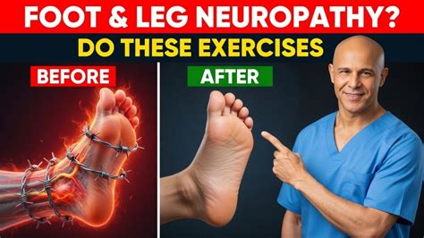 The ONLY 6 Exercises YOU Need to Relieve Neuropathy in Feet & Legs | Dr ...