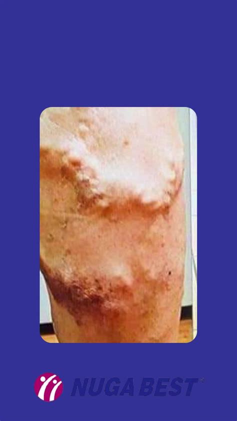 This incredible transformation is a real-life example of the benefits ...