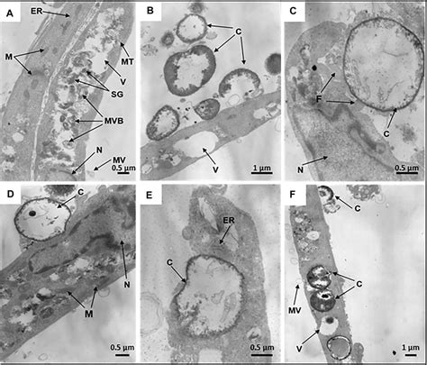 Frontiers | Human Mesenchymal Stem Cells as a Carrier for a Cell ...