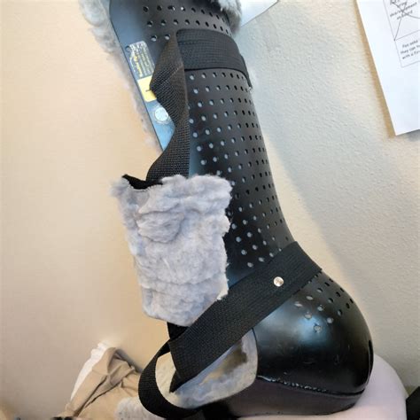 Amy's Foot Surgery &Blood Clots - Give InKind