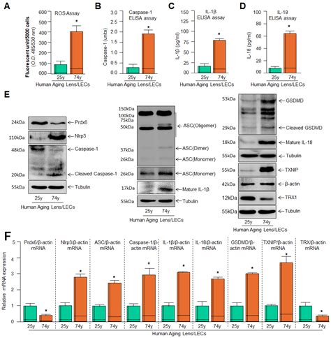 TXNIP-Deficiency and Prdx6 Delivery Inhibit Aging/Oxidative Stress–Driven TXNIP-Nlrp3 ...