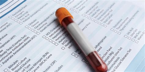 Rangos de Laboratorio: Por qué “Normal” no Siempre Significa Salud ...