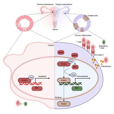 Single-cell analysis reveals insights into epithelial abnormalities in ...