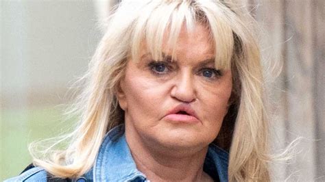 Danniella Westbrook reveals new look after full face, neck and brow lift - but she isn't ...