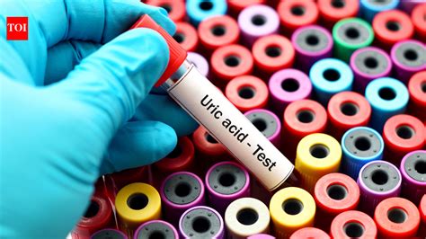 Uric Acid: 6 vegetables that are helpful in reducing uric acid levels ...