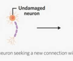1.2.3 Neuroplasticity Flashcards | Quizlet