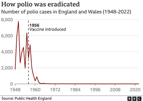 Polio: What is it and how does it spread?