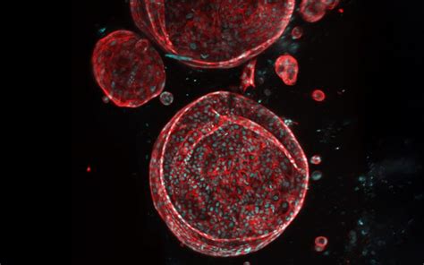 Carnegie Mellon Leads $28.5M Effort to Create Regenerative Bioprinted ...