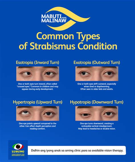 🚀 Join Our... - Lusung Vision Therapy and Phototherapy Clinic | Facebook