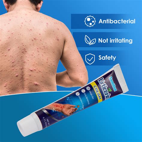 Buy KAOU 20g Urticaria Cream Fast Absorbing Relieve Itching External ...