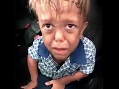 Global support for Australian boy bullied over dwarfism