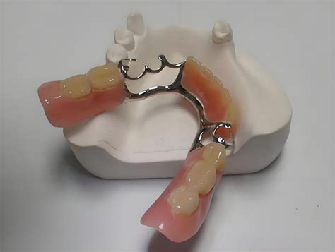 Image result for Bottom Front Teeth Partials