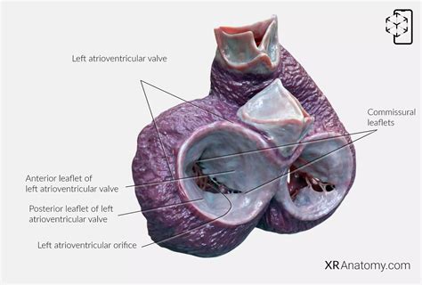 Left Atrioventricular Valve AR Atlas