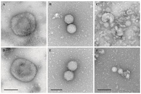 Evaluation of Virus Inactivation by Formaldehyde to Enhance Biosafety ...
