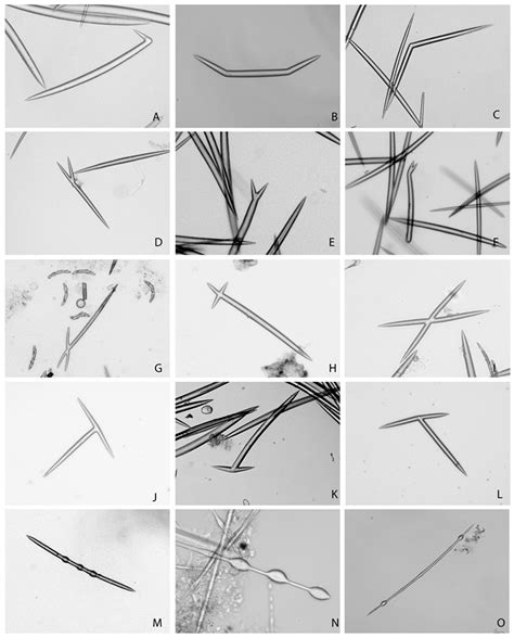 Anomalies of Sponge Spicules: Exploring Links to Environmental Pollution