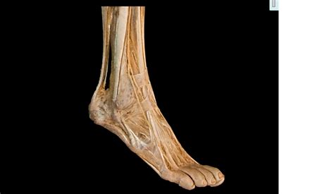 Image result for Toe Lateral View