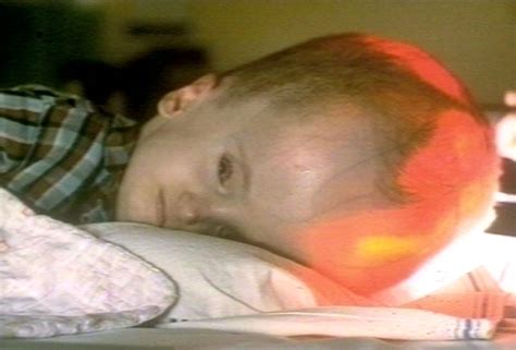 Image result for Transillumination Normal Head