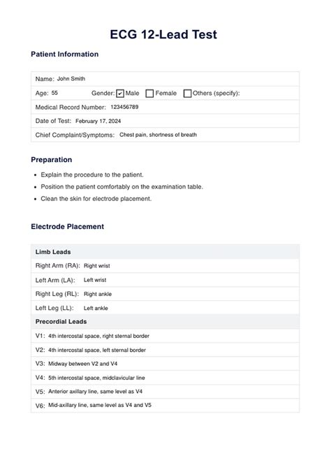 ECG 12-Lead Test & Example | Free PDF Download