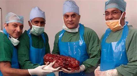 Surgeons remove 16-pound cyst-covered kidney from patient, plan to ...
