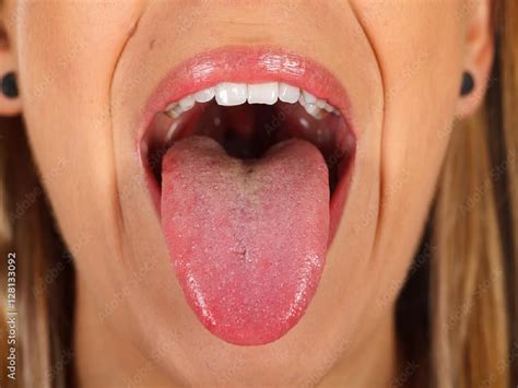 Your Tongue Could Tell Whether Or Not You Have Heart Disease ...