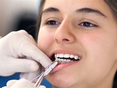 Best dental clinic in coimbatore | Toothcare Dental Clinic