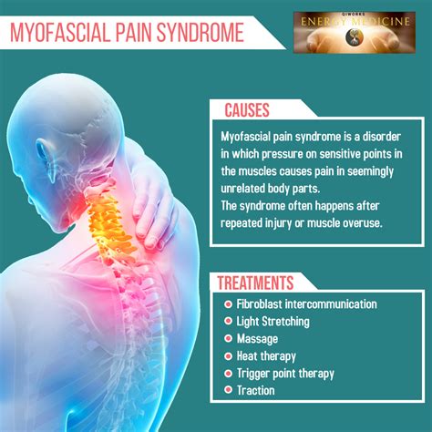 Myofascial Pain Syndrome Curable