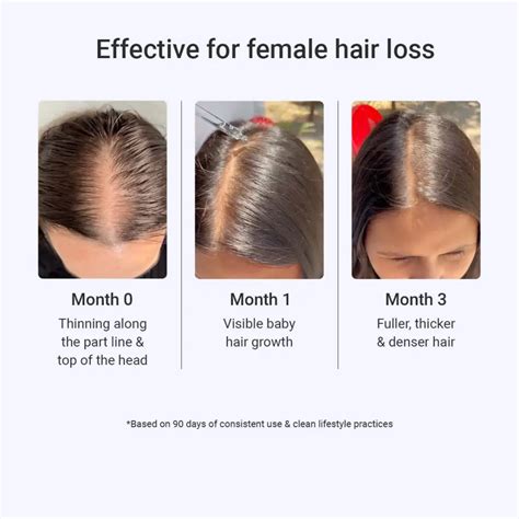 Intensive Hair Growth Serum | Derma Roller (FREE) – Arata