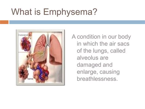 Image result for Emphysema Example