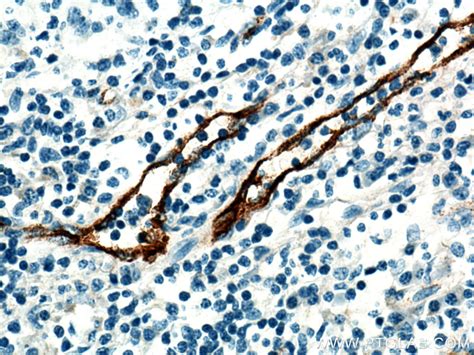 VWF antibody (27186-1-AP) | Proteintech