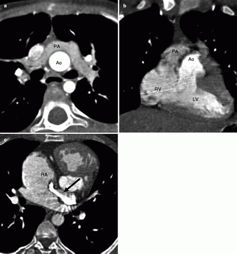 Switch Procedure 的图像结果